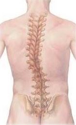 Functionele scoliose, kromming van de rug